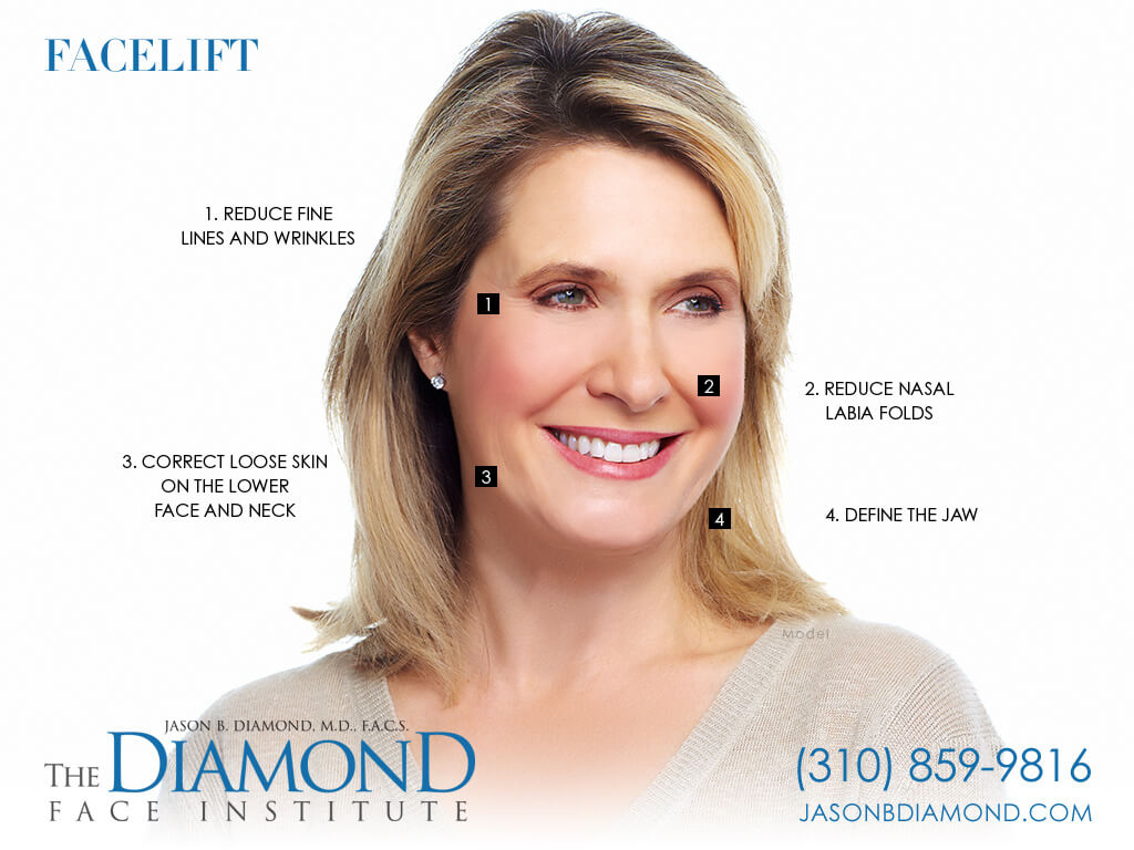 Infographic - Facelift | The Diamond Face Institute