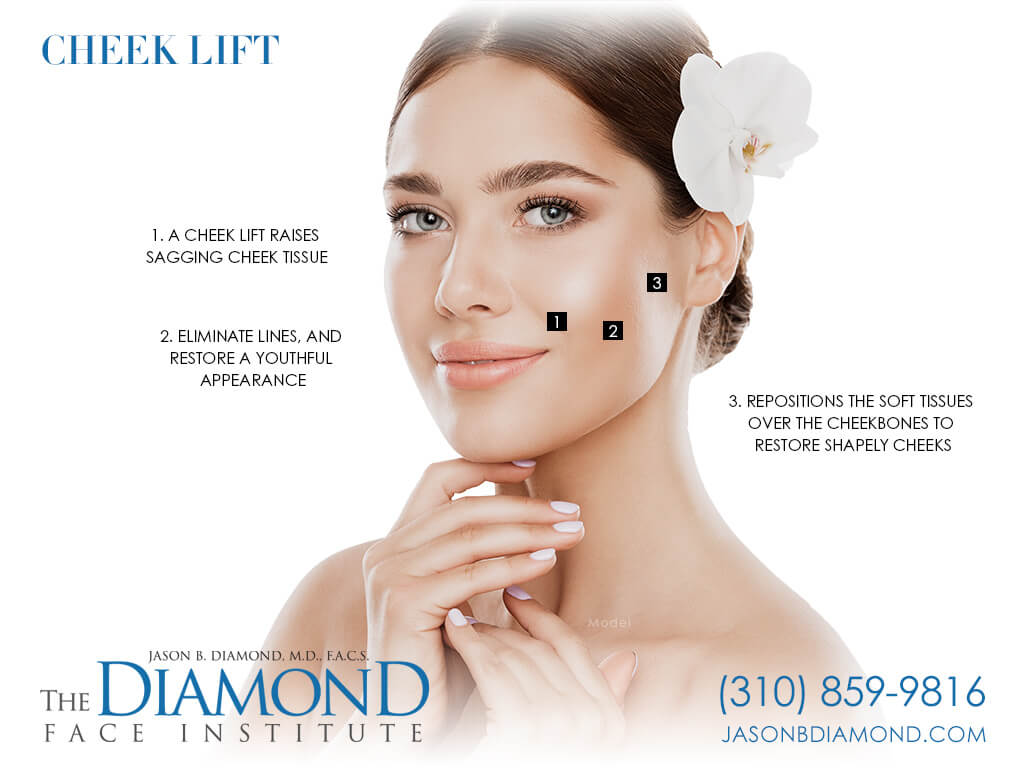 Infographic Cheek Lift | The Diamond Face Institute