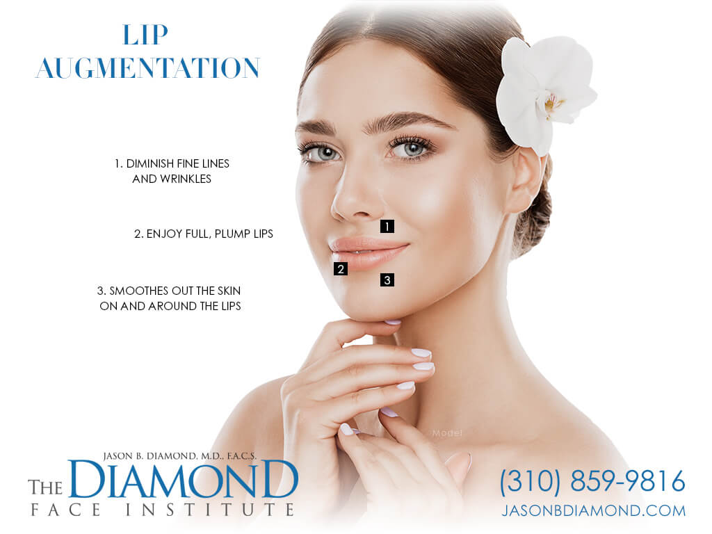 Infographic Lip Augmentation | The Diamond Face Institute