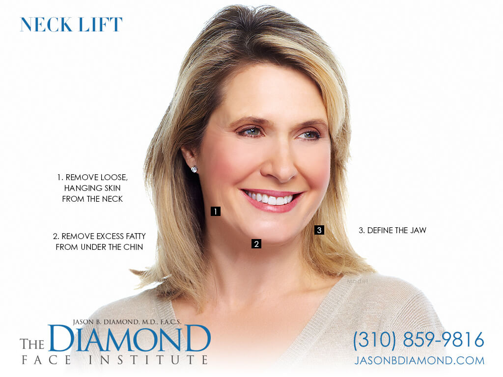 Infographic: Neck Lift | The Diamond Face Institute