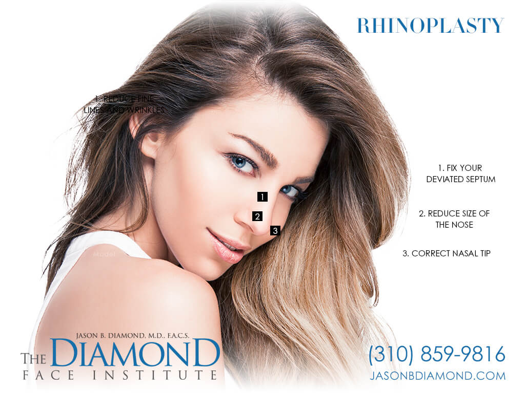 Infographic Rhinoplasty | The Diamond Face Institute